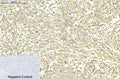 ABCB5 Monoclonal Antibody(11A2) – Figure 1 of 3