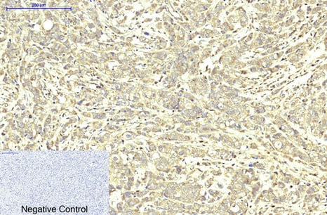 ABCB5 Monoclonal Antibody(11A2) – Figure 1 of 3