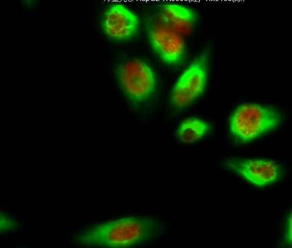 Bcl-2 Monoclonal Antibody(6B5) – Figure 1 of 18