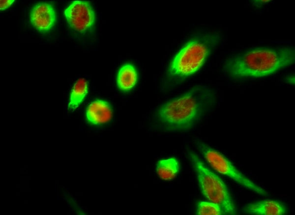 CHOP mouse Monoclonal Antibody(2B1) – Figure 1 of 6