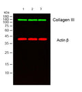 Collagen III Monoclonal Antibody(Q76) – Figure 1 of 7