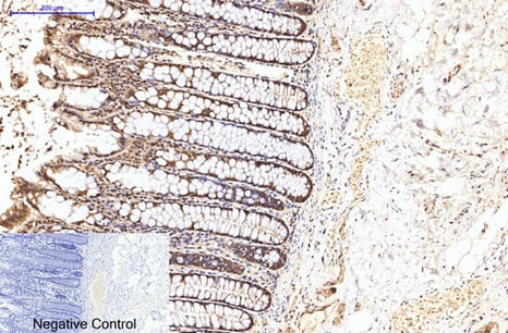 eIF4A1 Monoclonal Antibody(M8) – Figure 1 of 6