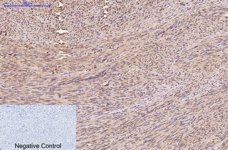FH Monoclonal Antibody(7F1) – Figure 1 of 6