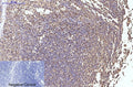 HSP90Beta Monoclonal Antibody(M2) – Figure 1 of 6