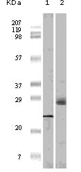 4E-BP1 Monoclonal Antibody – Figure 1 of 1