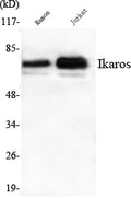 Ikaros Monoclonal Antibody – Figure 1 of 1