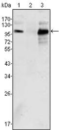 AR Monoclonal Antibody – Figure 1 of 2