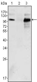 AR Monoclonal Antibody – Figure 1 of 2
