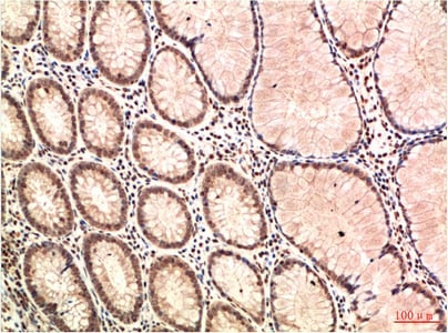 ATM mouse Monoclonal Antibody(4G9) – Figure 1 of 2