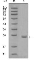 Axl Monoclonal Antibody – Figure 1 of 1