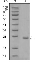 Axl Monoclonal Antibody – Figure 1 of 1