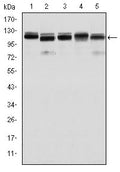 BMPR-II Monoclonal Antibody – Figure 1 of 3