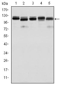 BMPR-II Monoclonal Antibody – Figure 1 of 3