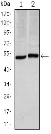 CA IX Monoclonal Antibody – Figure 1 of 3