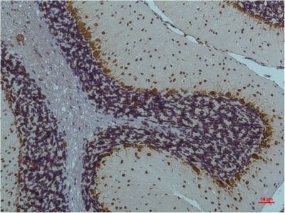 CaMKII Beta/Gamma/Delta (Phospho Thr287) Monoclonal Antibody(1B9) – Figure 1 of 2