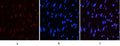 CD10 Monoclonal Antibody(5B8) – Figure 1 of 6