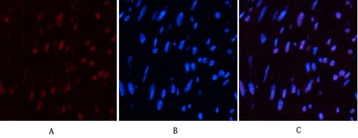 CD10 Monoclonal Antibody(5B8) – Figure 1 of 6