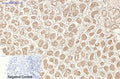 CD21 Monoclonal Antibody(2C5) – Figure 1 of 4