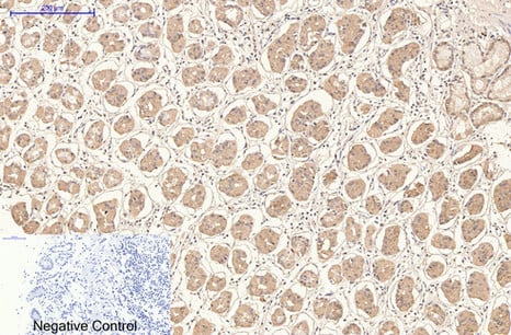 CD21 Monoclonal Antibody(2C5) – Figure 1 of 4
