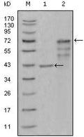 Chitotriosidase Monoclonal Antibody – Figure 1 of 1