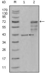 Chitotriosidase Monoclonal Antibody – Figure 1 of 1