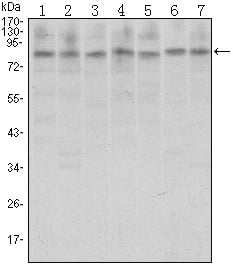 CTCF Monoclonal Antibody – Figure 1 of 1