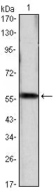 Cyclin D1 Monoclonal Antibody – Figure 1 of 1
