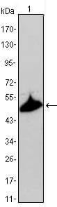 Cytokeratin 15 Monoclonal Antibody – Figure 1 of 4