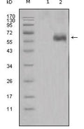 Dkk-1 Monoclonal Antibody – Figure 1 of 1