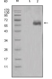 Dkk-1 Monoclonal Antibody – Figure 1 of 1