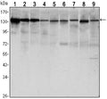 E-cadherin Monoclonal Antibody – Figure 1 of 3