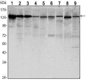 E-cadherin Monoclonal Antibody – Figure 1 of 3