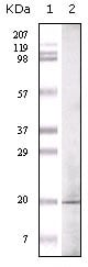 EHMT1 Monoclonal Antibody – Figure 1 of 1