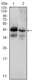 EP-CAM Monoclonal Antibody – Figure 1 of 2