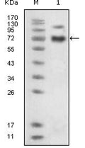 EphB4 Monoclonal Antibody – Figure 1 of 2