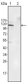 EphB4 Monoclonal Antibody – Figure 1 of 1