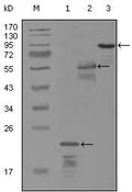 ErbB-3 Monoclonal Antibody – Figure 1 of 1