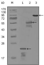 ErbB-3 Monoclonal Antibody – Figure 1 of 1