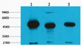 FH Fumarase Monoclonal Antibody(2B11) – Figure 1 of 1