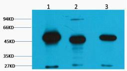 FH Fumarase Monoclonal Antibody(2B11) – Figure 1 of 1