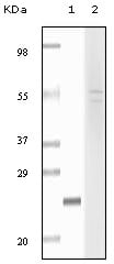 Fibulin-5 Monoclonal Antibody – Figure 1 of 1
