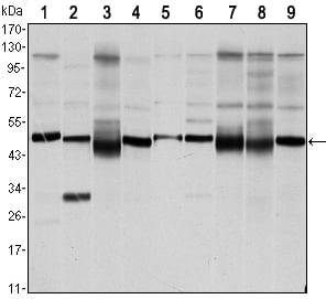 FoxD3 Monoclonal Antibody – Figure 1 of 1