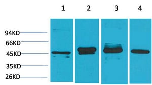 GAP-43 Monoclonal Antibody(Mix) – Figure 1 of 2