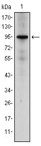 GR Monoclonal Antibody – Figure 1 of 4