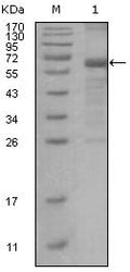 GTBP Monoclonal Antibody – Figure 1 of 1