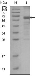 GTBP Monoclonal Antibody – Figure 1 of 1