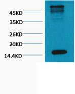 Histone H3 (Tri Methyl Lys79) Monoclonal Antibody(1B7) – Figure 1 of 1