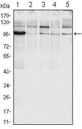 IRE1 Alpha Monoclonal Antibody – Figure 1 of 2