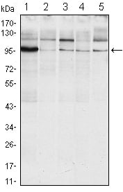 IRE1 Alpha Monoclonal Antibody – Figure 1 of 2