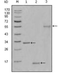 Ki-67 Monoclonal Antibody – Figure 1 of 1